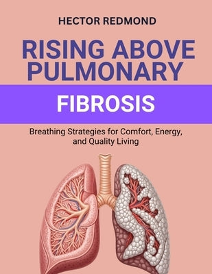 Rising Above Pulmonary Fibrosis: Breathing Strategies for Comfort, Energy, and Quality Living by Redmond, Hector
