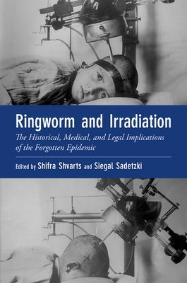 Ringworm and Irradiation: The Historical, Medical, and Legal Implications of the Forgotten Epidemic by Shvarts, Shifra