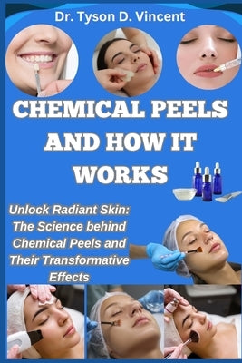 Chemical Peels and How It Works: Unlock Radiant Skin: The Science behind Chemical Peels and Their Transformative Effects by D. Vincent, Tyson