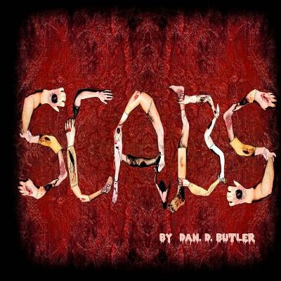 Scabs: Picking Apart The Facts by Butler, Dan