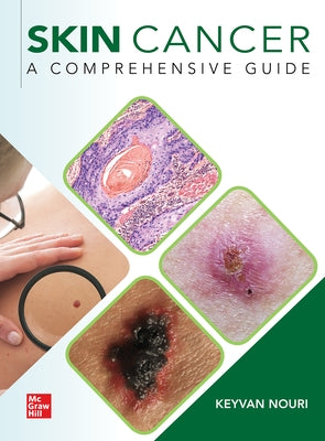 Skin Cancer: A Comprehensive Guide by Nouri, Keyvan
