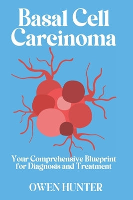 Basal Cell Carcinoma: Your Comprehensive Blueprint for Diagnosis and Treatment by Hunter, Owen