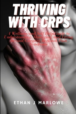 Thriving With CRPS: A Wellness and Self-Help Guide to Understanding, Managimg, and Living Beyond Complex Regional Pain Syndrome by J. Marlowe, Ethan