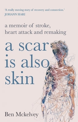 A Scar Is Also Skin by McKelvey, Ben