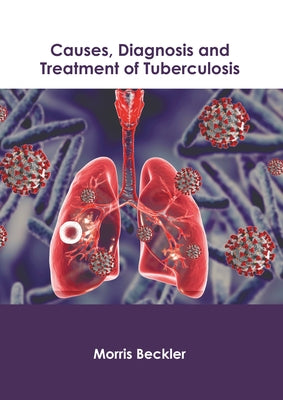 Causes, Diagnosis and Treatment of Tuberculosis by Beckler, Morris