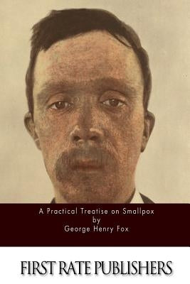 A Practical Treatise on Smallpox by Fox, George Henry