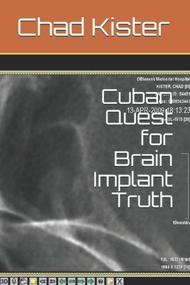 Cuban Quest for Brain Implant Truth by Kister, Chad
