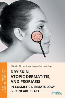 Dry Skin, Atopic Dermatitis, and Psoriasis in Cosmetic Dermatology & Skincare Practice by Hernandez-Jimenez, Elena
