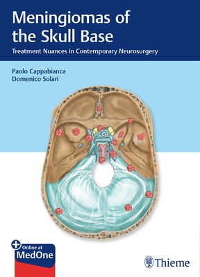 Meningiomas of the Skull Base: Treatment Nuances in Contemporary Neurosurgery by Cappabianca, Paolo