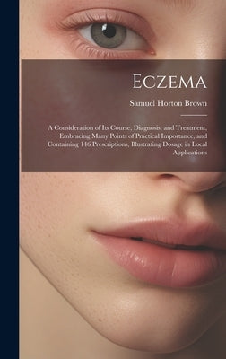 Eczema: A Consideration of Its Course, Diagnosis, and Treatment, Embracing Many Points of Practical Importance, and Containing by Brown, Samuel Horton