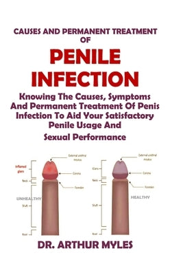 Causes and Permanent Treatment of Penile Infection: Knowing The Causes, Symptoms And Permanent Treatment Of Penis Infection To Aid Your Satisfactory P by Myles, Arthur