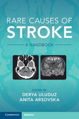 Rare Causes of Stroke: A Handbook by Uluduz, Derya