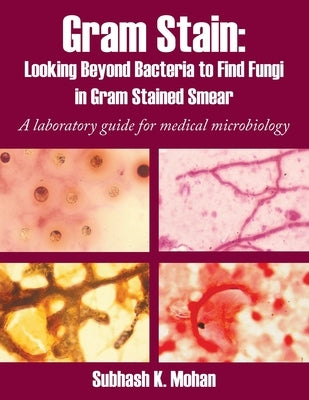 Gram Stain: Looking Beyond Bacteria to Find Fungi in Gram Stained Smear: A Laboratory Guide for Medical Microbiology by Mohan, Subhash K.