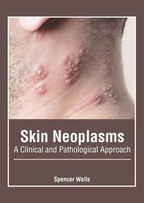 Skin Neoplasms: A Clinical and Pathological Approach by Wells, Spencer