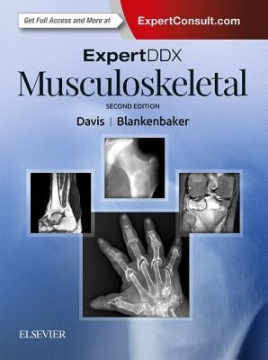 Expertddx: Musculoskeletal by Davis, Kirkland W.