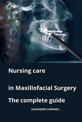 Nursing Care in Maxillofacial Surgery The complete Guide by Carewell, Alexandre