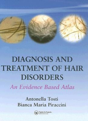 Diagnosis and Treatment of Hair Disorders: An Evidence-Based Atlas by Tosti, Antonella