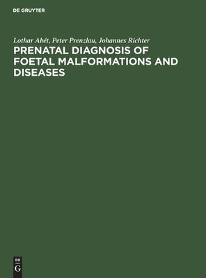 Prenatal Diagnosis of Foetal Malformations and Diseases by Abét Prenzlau Richter, Lothar Peter Joh