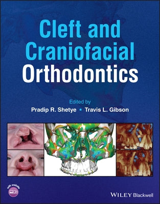Cleft and Craniofacial Orthodontics by Shetye, Pradip R.