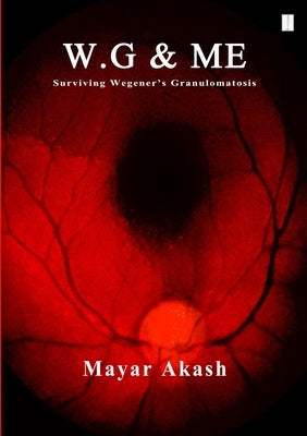 W.G & ME, Surviving Wegener's Granulomatosis: Wegener's Granulomatosis by Akash, Mayar