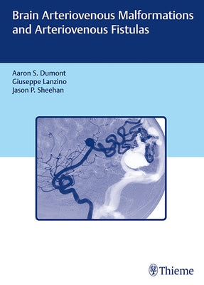 Brain Arteriovenous Malformations and Arteriovenous Fistulas by Dumont, Aaron S.