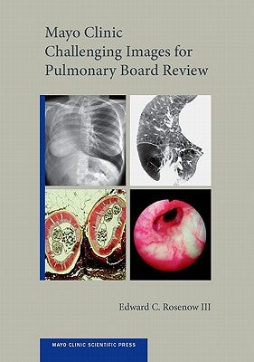 Mayo Clinic Challenging Images for Pulmonary Board Review by Rosenow III, Edward C.