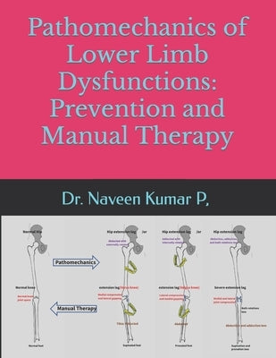 Pathomechanics of Lower limb dysfunctions: Prevention and Manual Therapy by P, Naveen Kumar