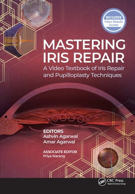 Mastering Iris Repair: A Video Textbook of Iris Repair and Pupilloplasty Techniques by Agarwal, Ashvin