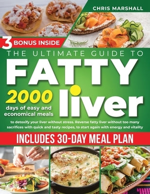 The Ultimate Guide to Fatty Liver Cookbook: 2000 days of Easy and Economical meals to Detoxify your Liver without stress. Reverse fatty liver without by Marshall, Chris