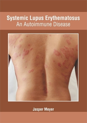 Systemic Lupus Erythematosus: An Autoimmune Disease by Meyer, Jasper