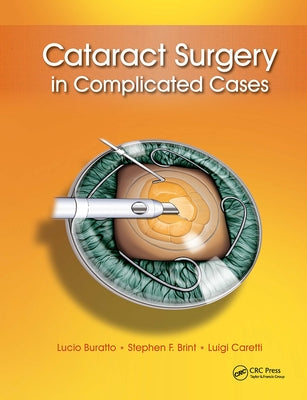 Cataract Surgery in Complicated Cases by Buratto, Lucio