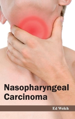 Nasopharyngeal Carcinoma by Welch, Ed