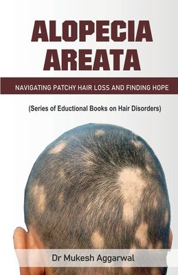 Alopecia Areata by Hair Loss, Navigating Patchy