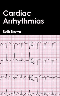 Cardiac Arrhythmias by Brown, Ruth