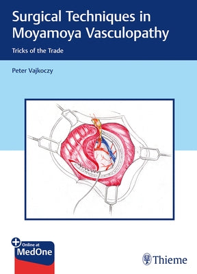 Surgical Techniques in Moyamoya Vasculopathy: Tricks of the Trade by Vajkoczy, Peter