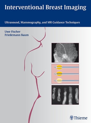 Interventional Breast Imaging: Ultrasound, Mammography, and MR Guidance Techniques by Fischer, Uwe