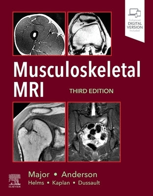 Musculoskeletal MRI by Major, Nancy M.