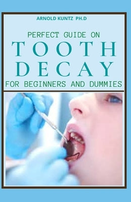 Perfect Guide on Tooth Decay for Beginners and Dummies: A Profound Guide to Heal and Prevent Your Teeth Naturally with Effective Dental Care by Kuntz Ph. D., Arnold
