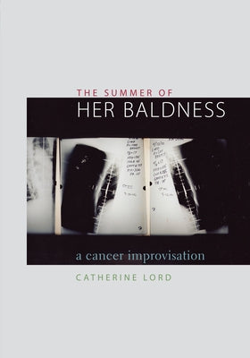 The Summer of Her Baldness: A Cancer Improvisation by Lord, Catherine