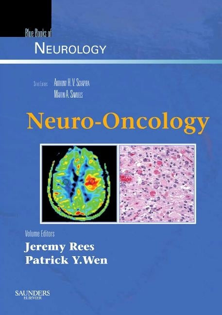 Neuro-Oncology: Blue Books of Neurology Series Volume 36 by Rees, Jeremy