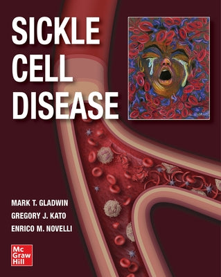 Sickle Cell Disease by Gladwin, Mark T.