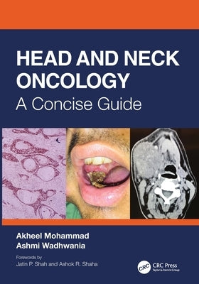 Head and Neck Oncology: A Concise Guide by Mohammad, Akheel