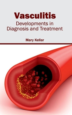 Vasculitis: Developments in Diagnosis and Treatment by Kellar, Mary