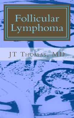 Follicular Lymphoma: Fast Focus Study GUide by Thomas MD, Jt