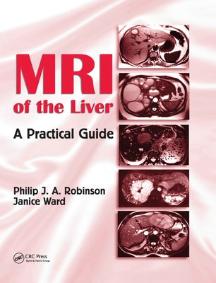 MRI of the Liver: A Practical Guide by Robinson, Philip J. a.