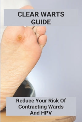 Clear Warts Guide: Reduce Your Risk Of Contracting Wards And Hpv: Does Duct Tape Get Rid Of Warts by Macaraeg, Maximina