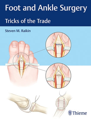 Foot and Ankle Surgery: Tricks of the Trade by Raikin, Steven M.