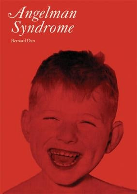 Angelman Syndrome by Dan, Bernard