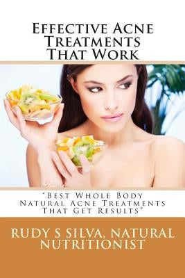 Effective Acne Treatments That Work: "Best Whole Body Natural Acne Treatments That Get Results" by Silva, Rudy Silva