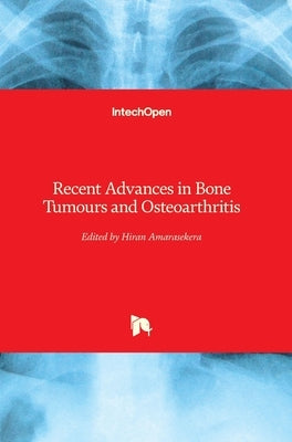 Recent Advances in Bone Tumours and Osteoarthritis by Amarasekera, Hiran